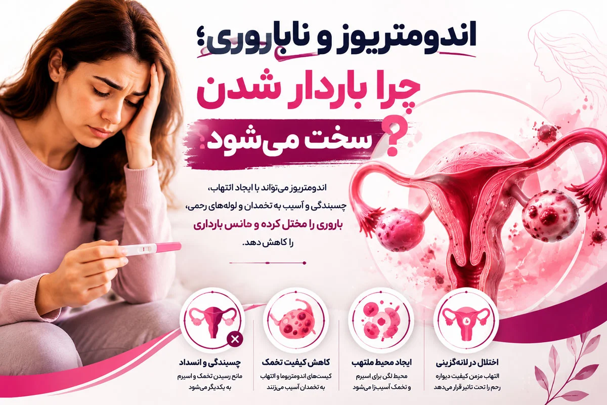 اندومتریوز چیست؟ علائم، تشخیص و تاثیر بر ناباروری و بارداری 2 اندومتریوز و ناباروری؛ چرا باردار شدن سخت میشود؟