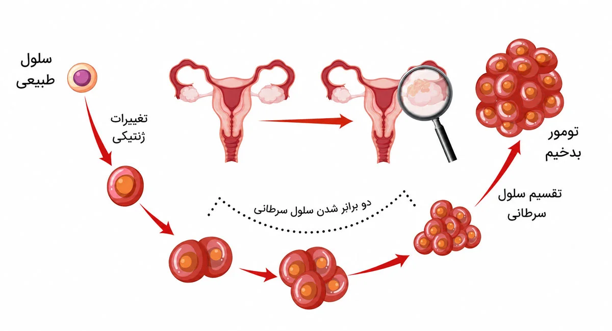 علت باردار نشدن در PCOS چیست؟
