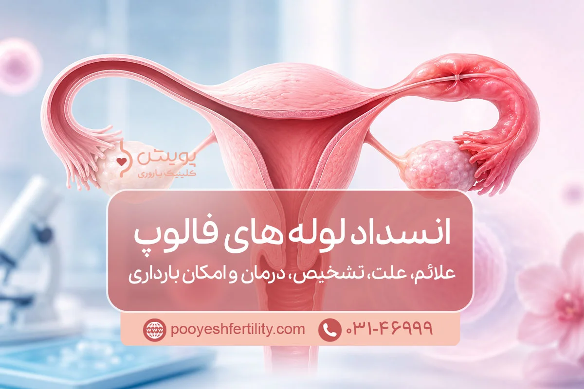 انسداد لوله‌ های فالوپ، علائم، علت، تشخیص، درمان و امکان بارداری