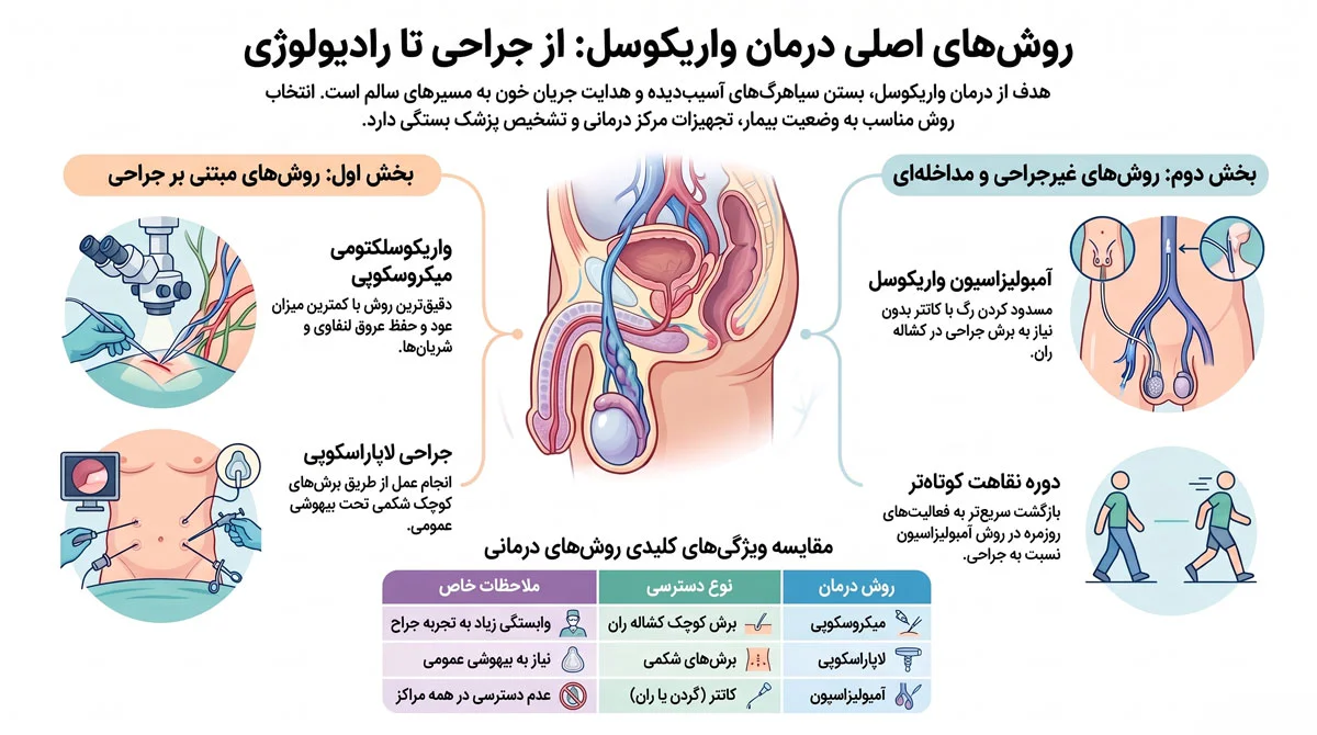 واریکوسل چیست؟ راهنمای علائم، گریدها و درمان درست 4 روشهای اصلی درمان واریکوسل