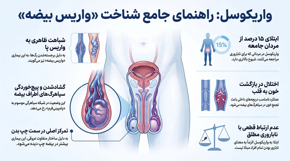 واریکوسل چیست؟ راهنمای علائم، گریدها و درمان درست 1 واریکوسل چیست؟