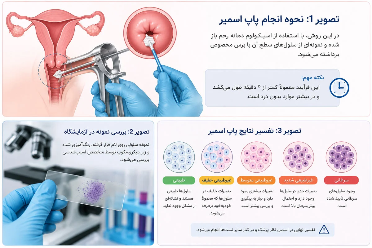 پاپ اسمیر چیست؟ بهترین زمان، نحوه انجام و معنی جواب 2 پاپ اسمیر چگونه انجام میشود؟