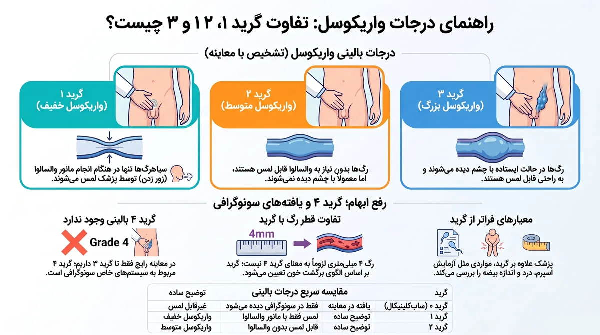 واریکوسل چیست؟ راهنمای علائم، گریدها و درمان درست 3 گریدهای واریکوسل