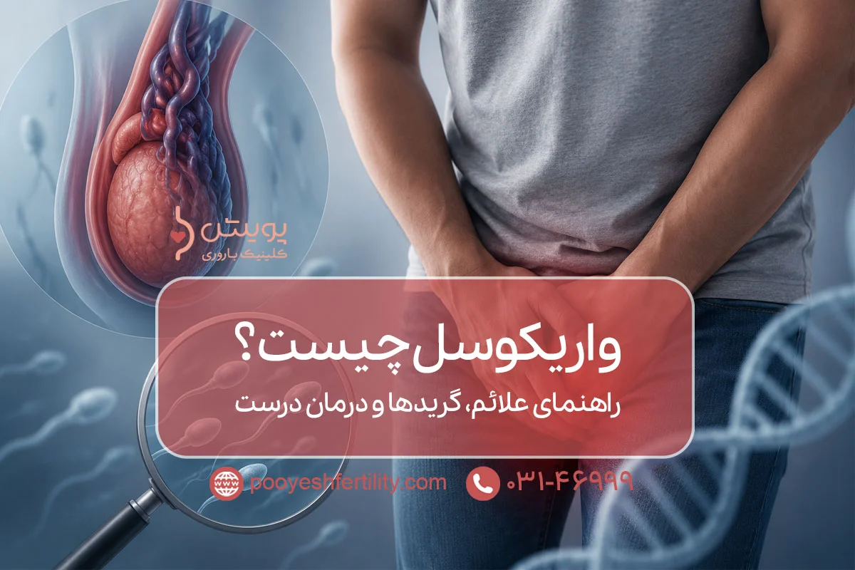 واریکوسل چیست؟ راهنمای علائم، گریدها و درمان درست